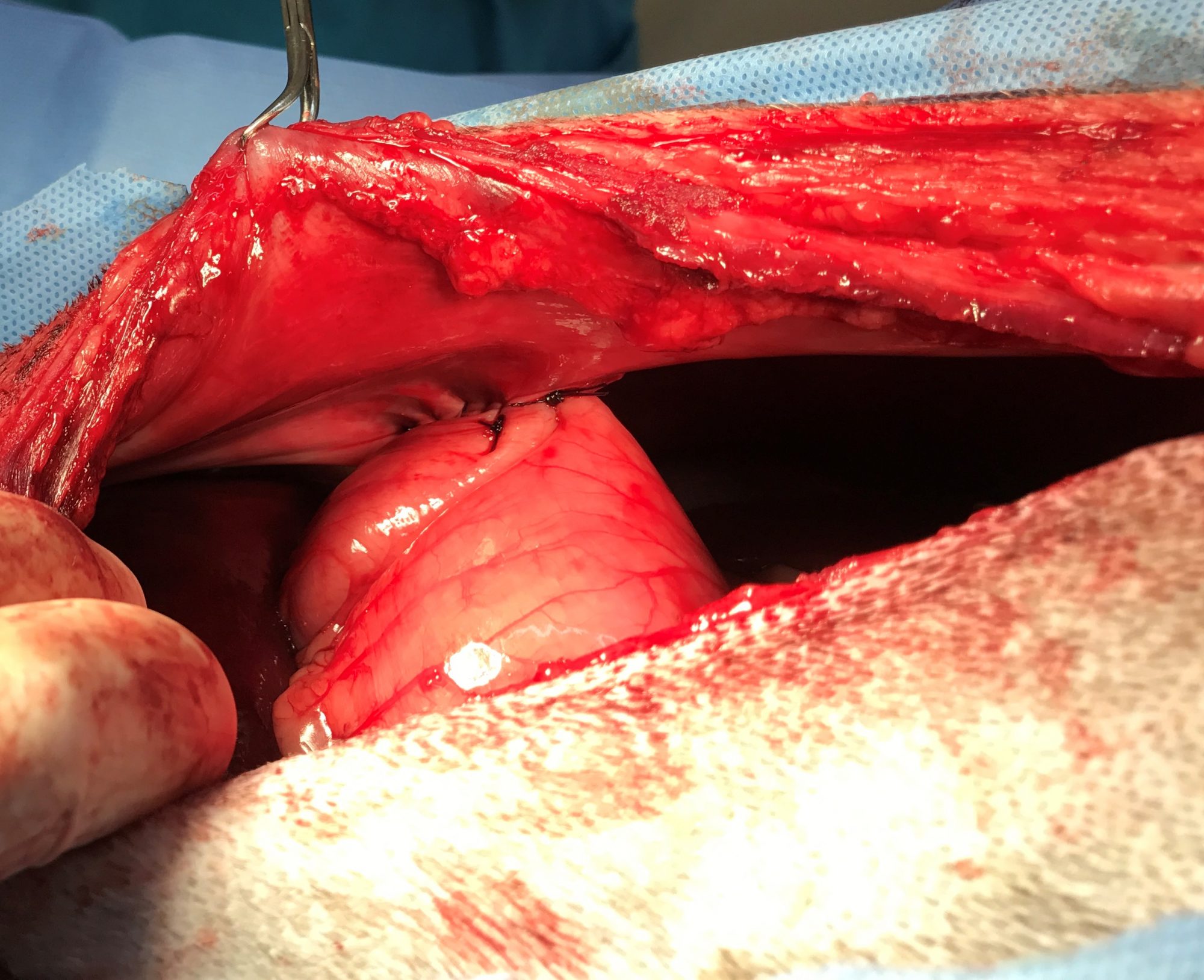 A gastropexy