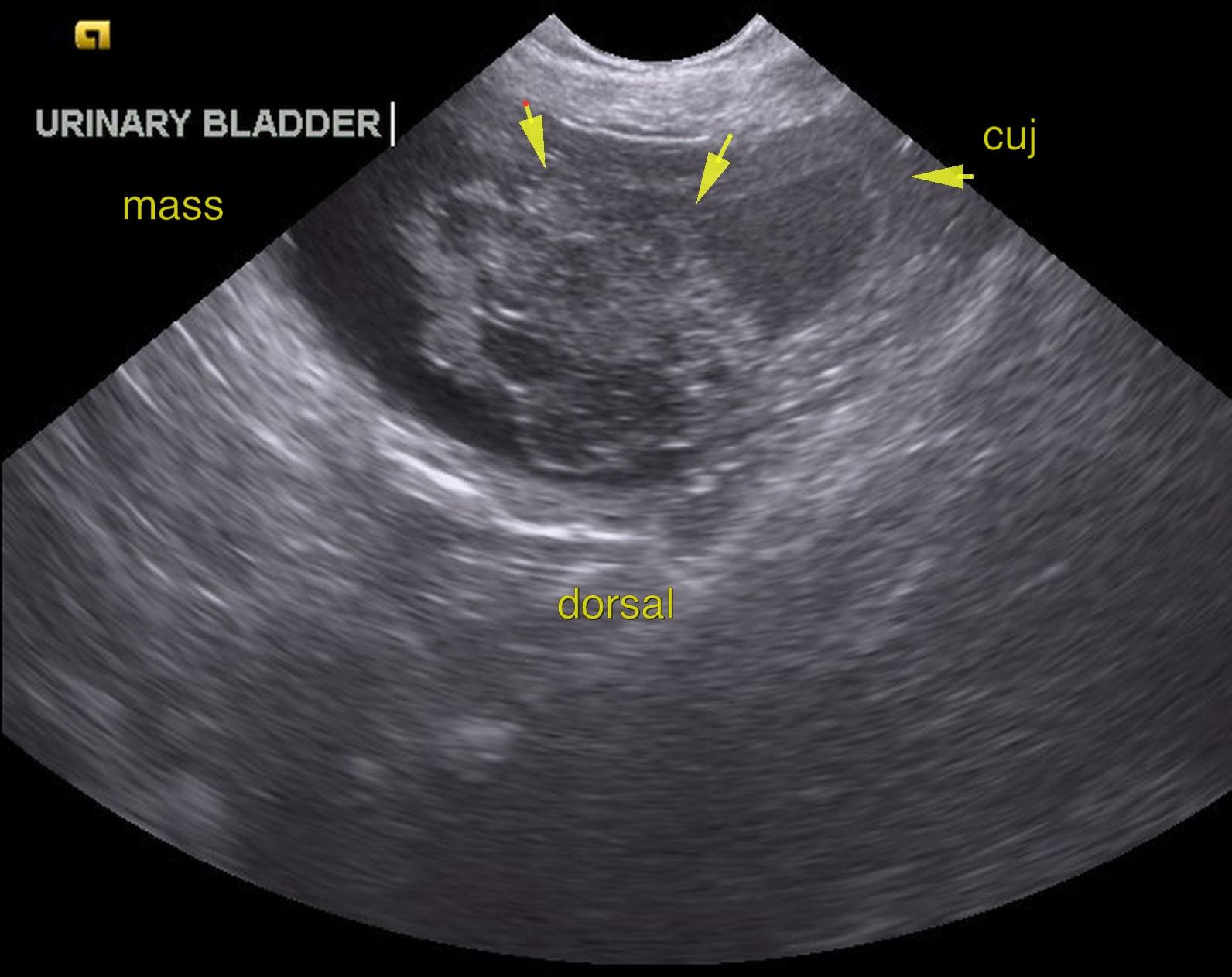 A bladder ultrasound