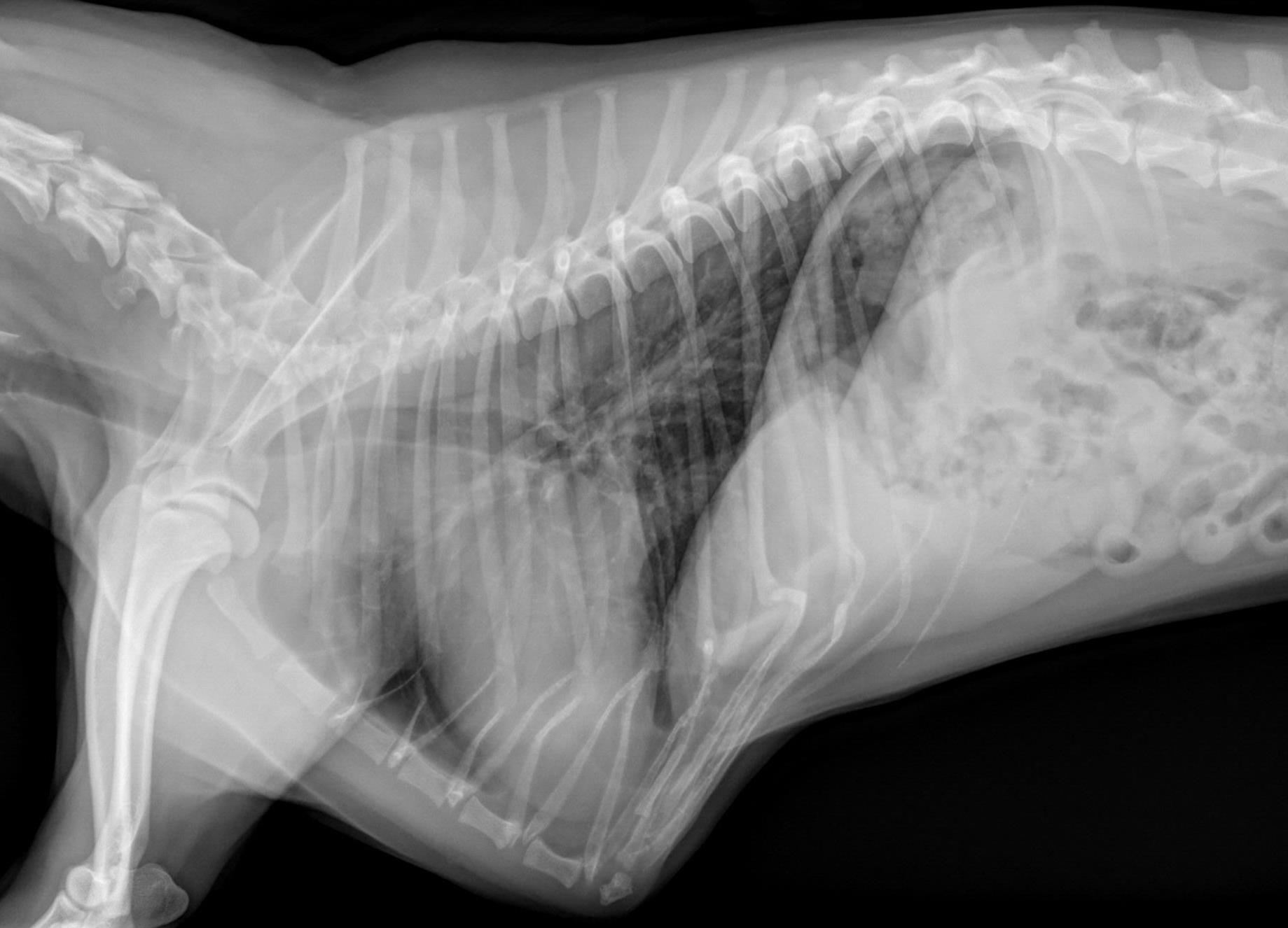 Blood work and chest x-rays look normal