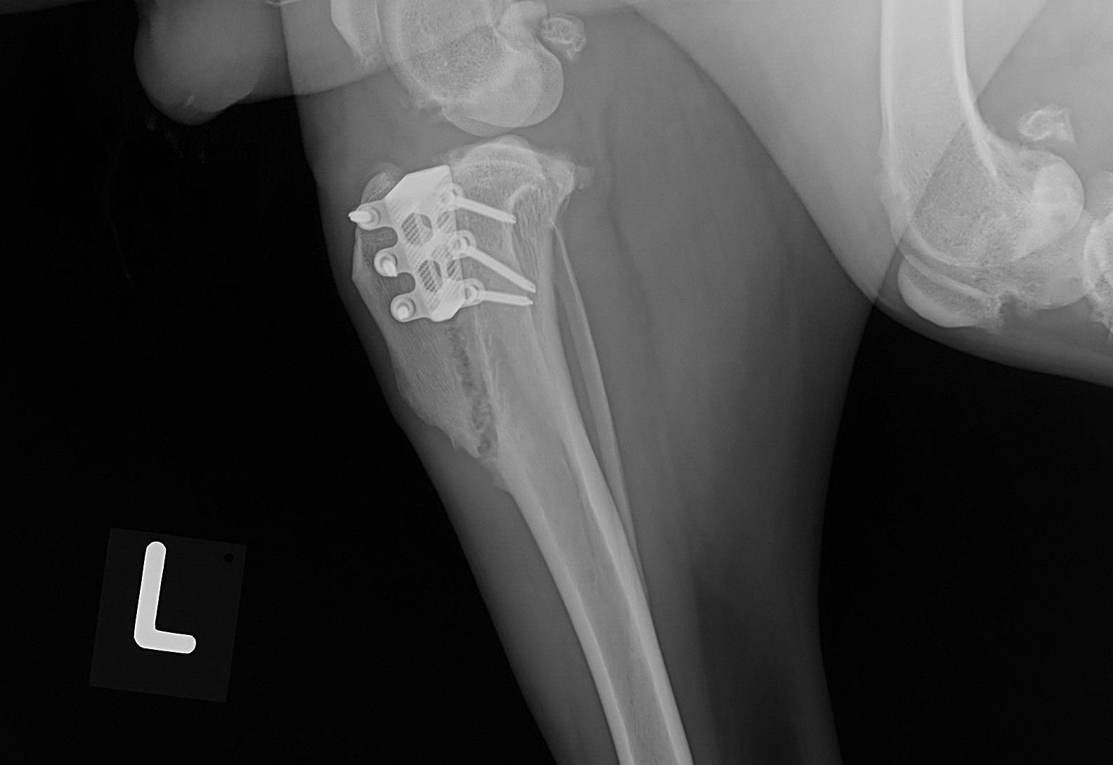 A metal plate with screws holding the joint together