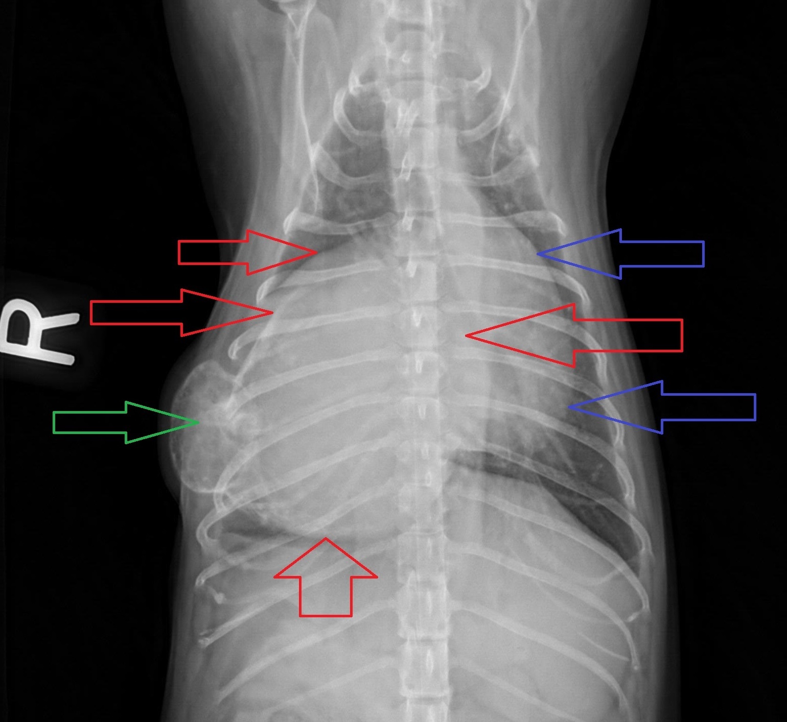 A chest x-ray showing the mass