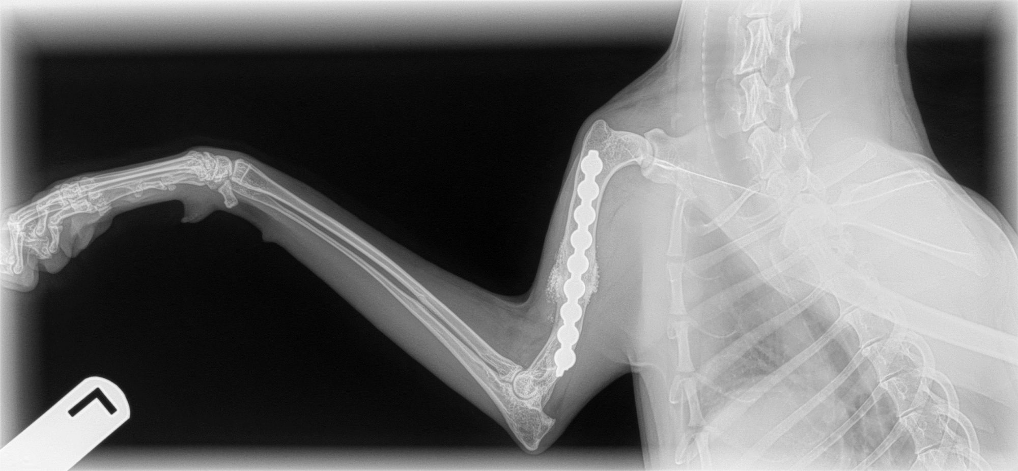 X-rays showing a healed break