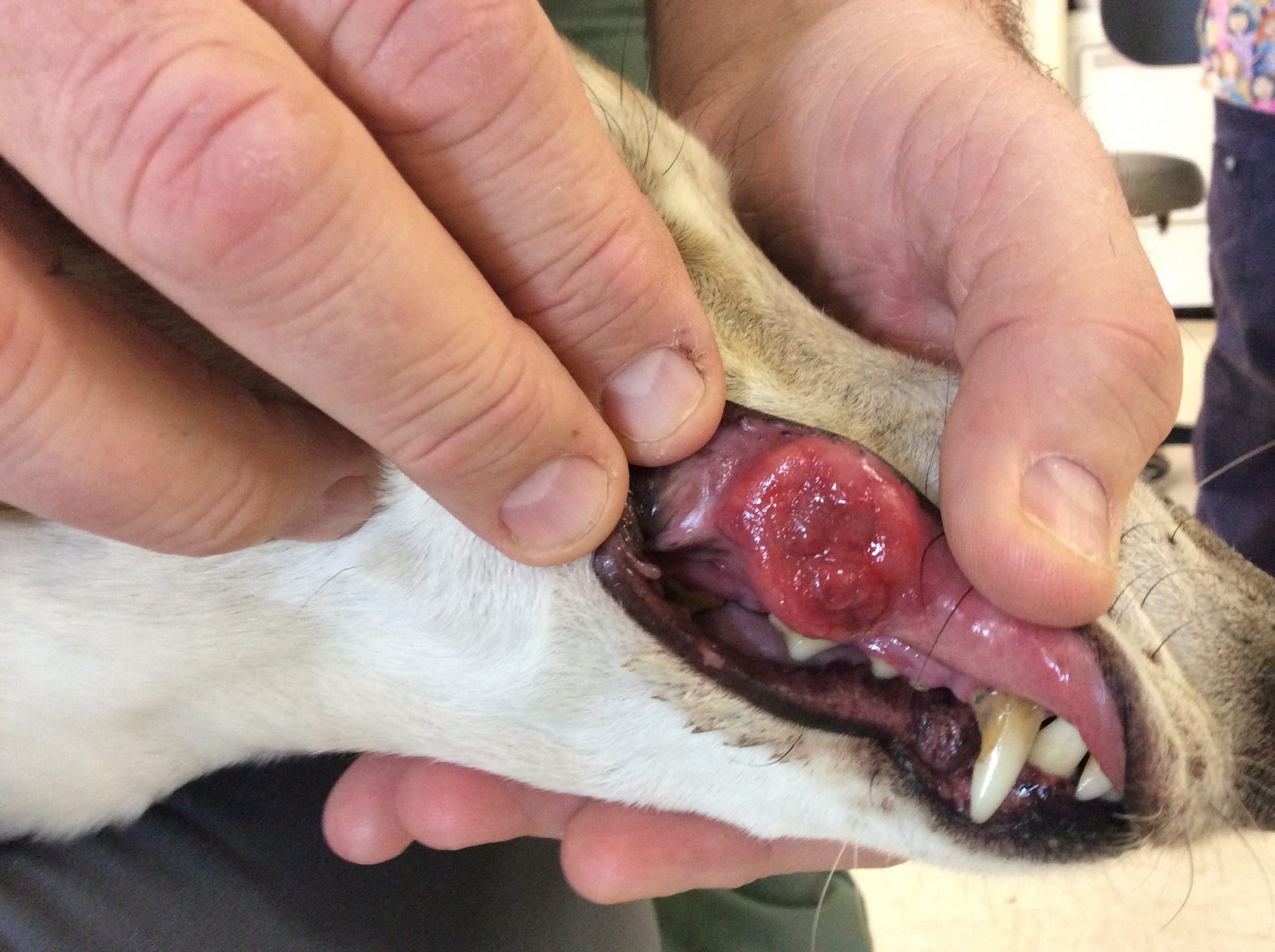 A tumor on the jaw