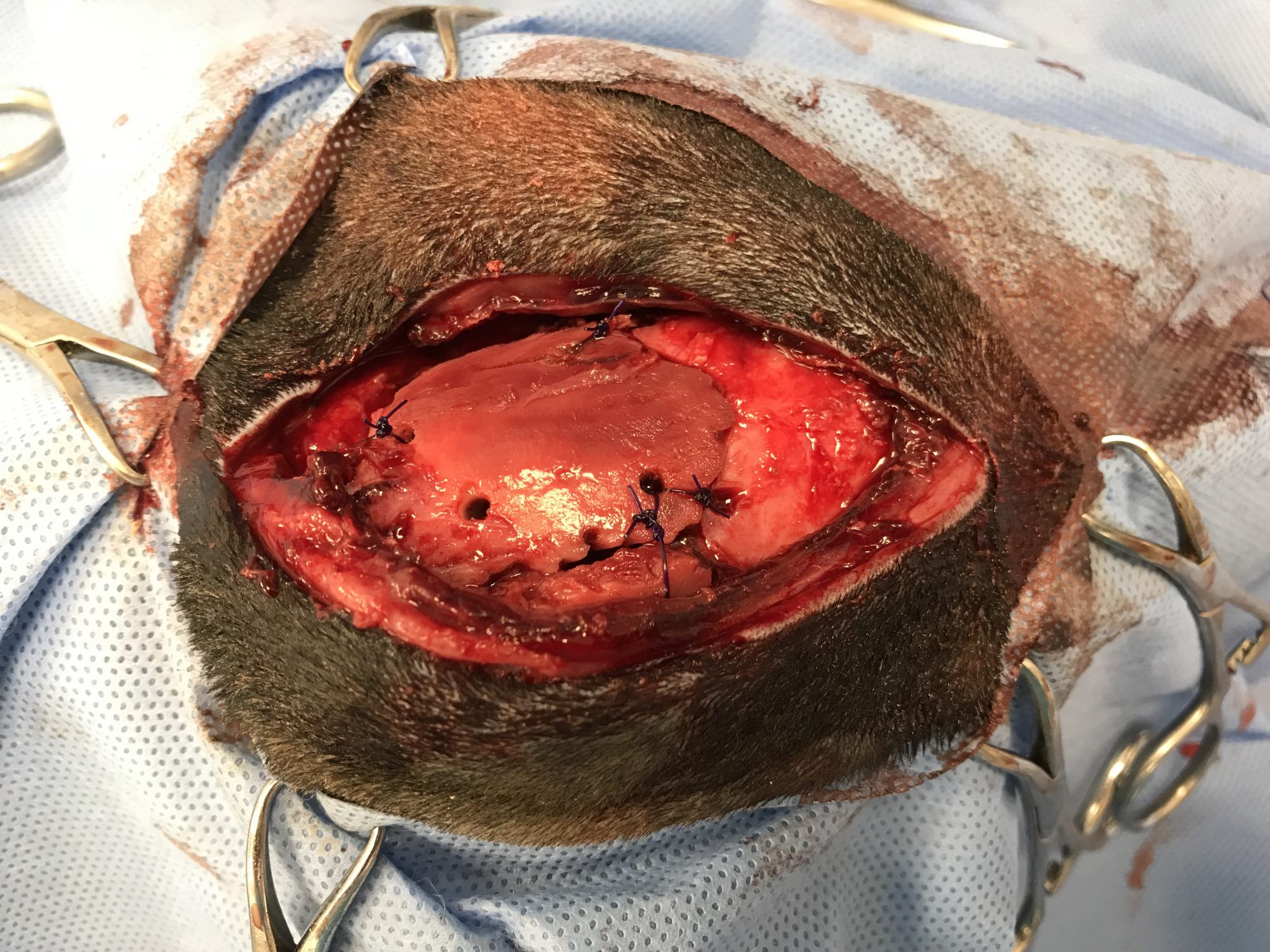 Skull surgery