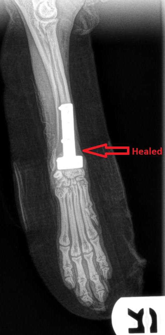 A healed forearm