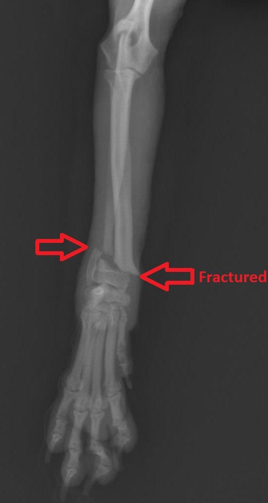 Fractured ulna and radius