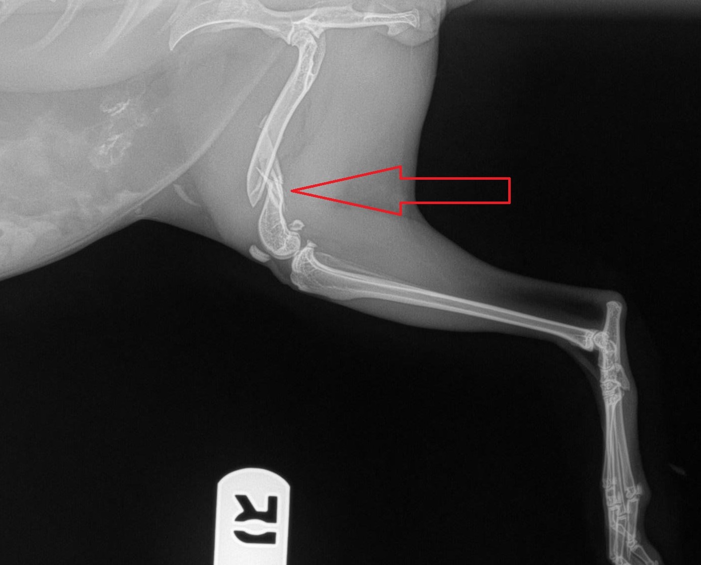 An x-ray of a broken bone