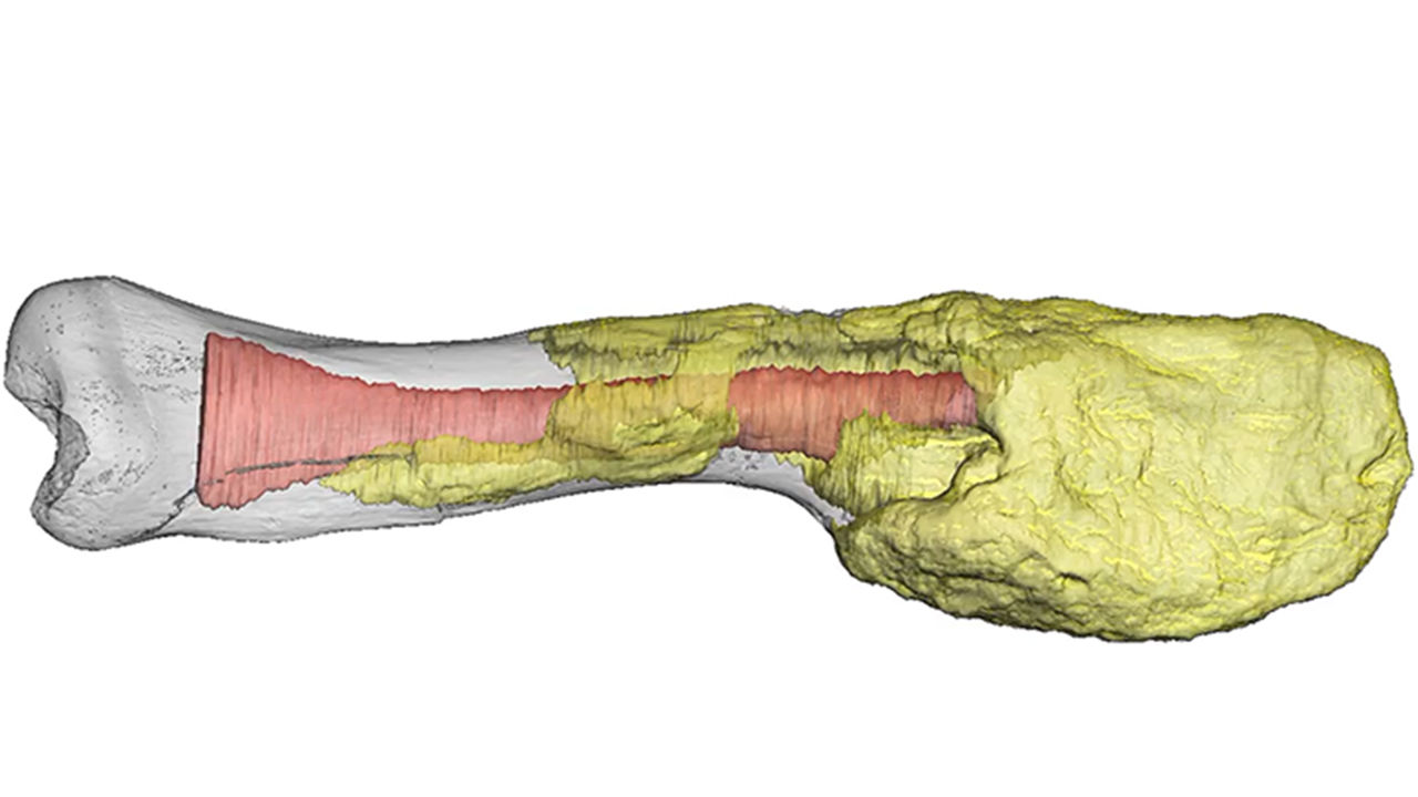 A fossil showing evidence of cancer