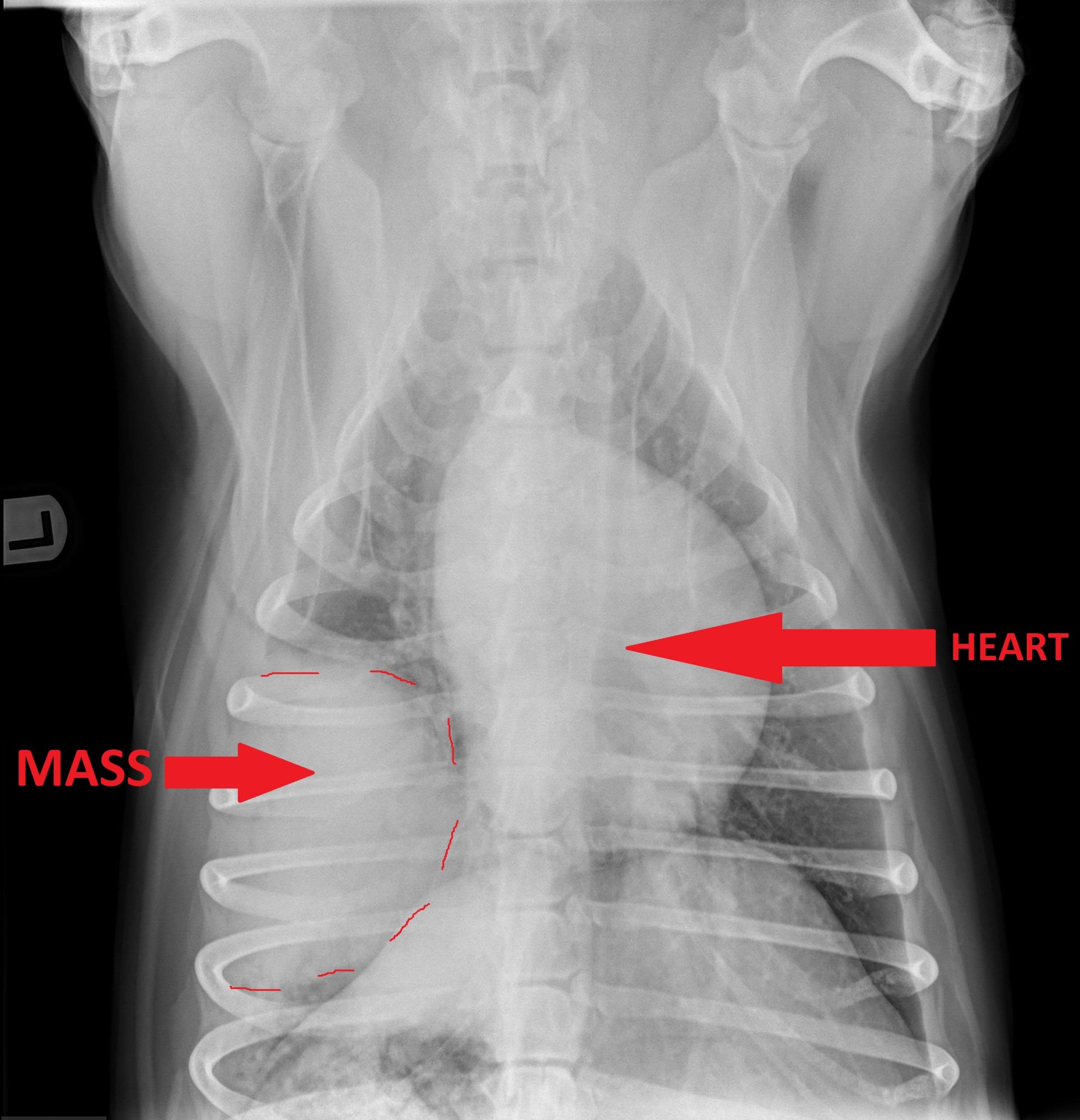 A mass in Nino's chest