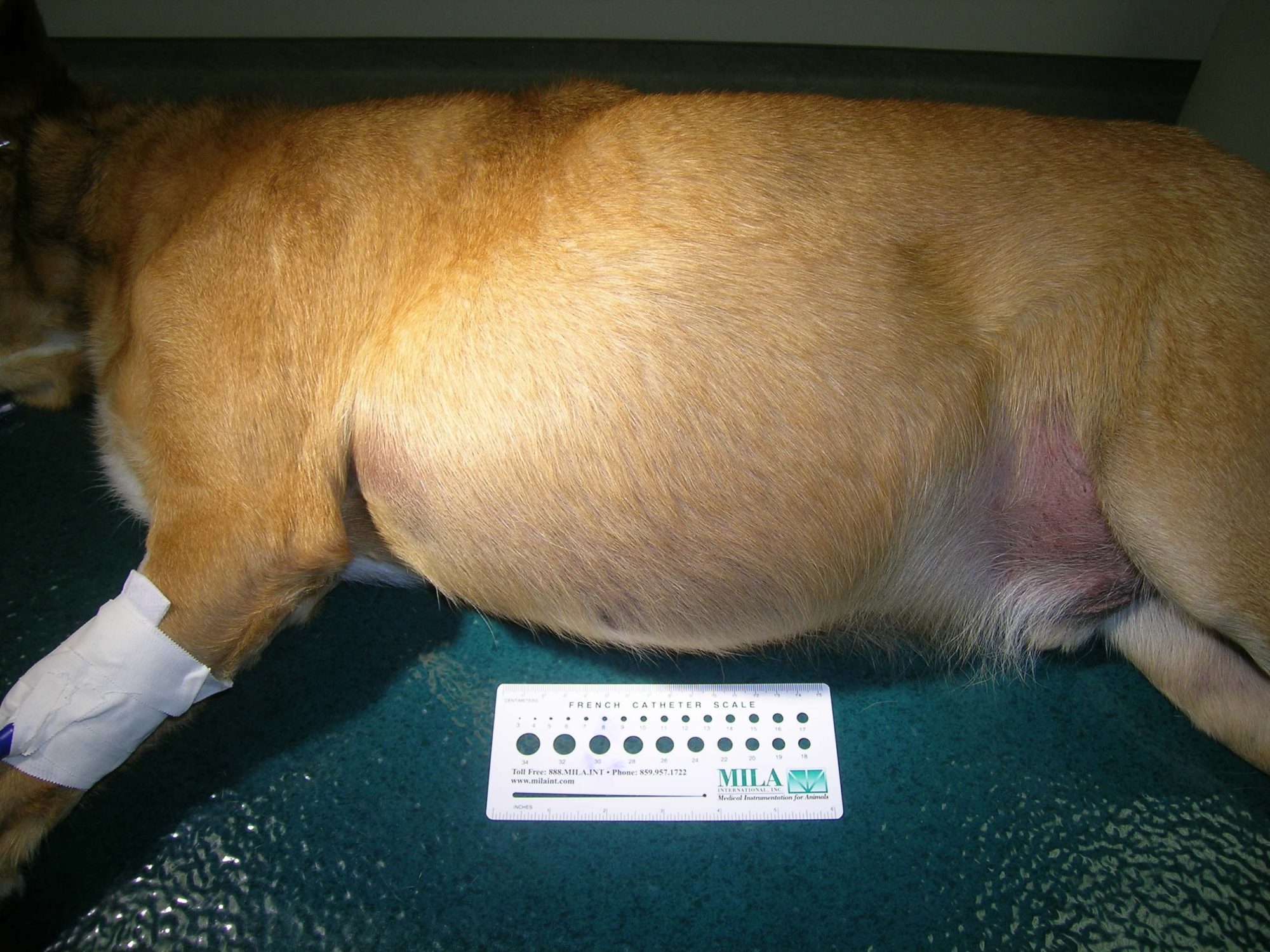 A benign skin mass