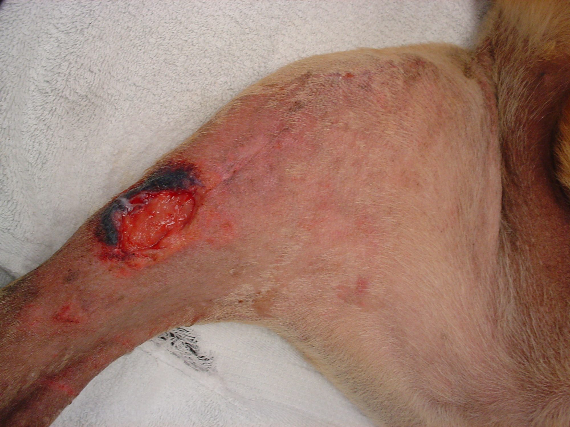 An incision that has reopened