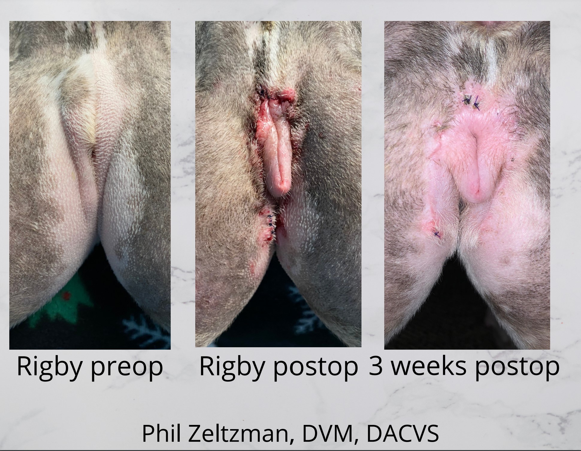 Pre-operative and post-operative