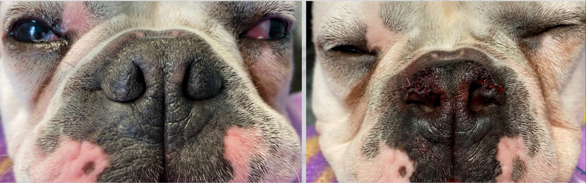 Pre-operative and post-operative