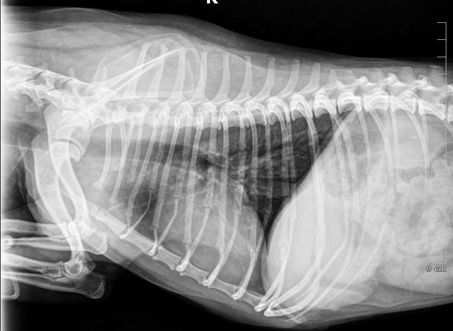 A chest x-ray before the operation