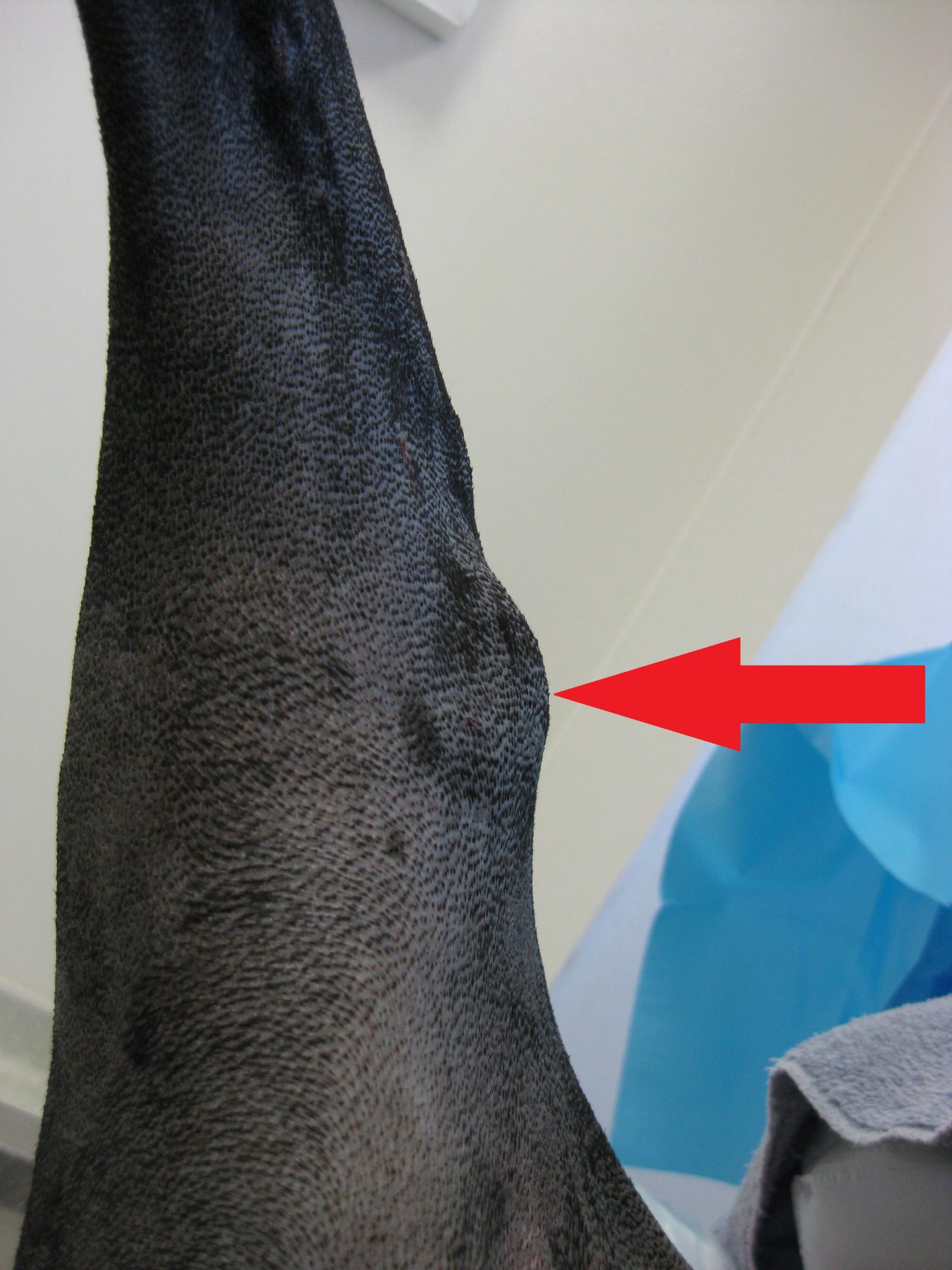 Medial Buttress