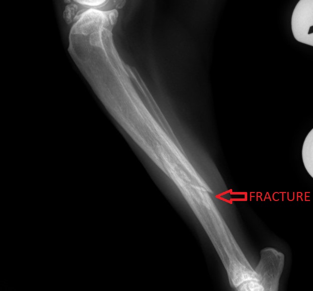 A fractured leg