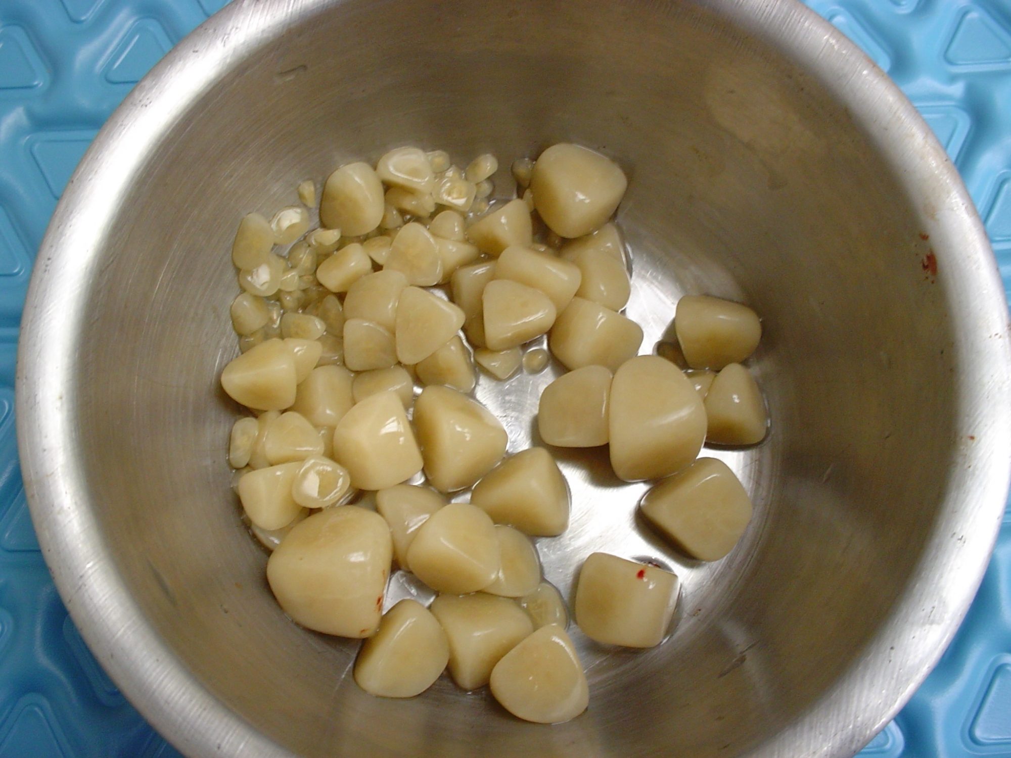 Bladder stones