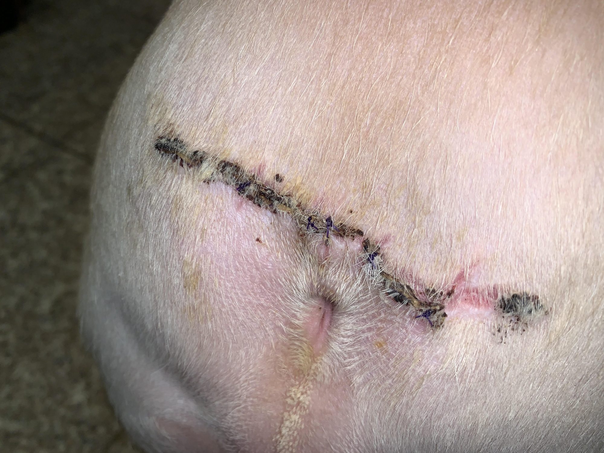 A healing incision