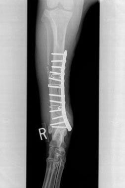 orthopedic-surgery orthopedic-surgery